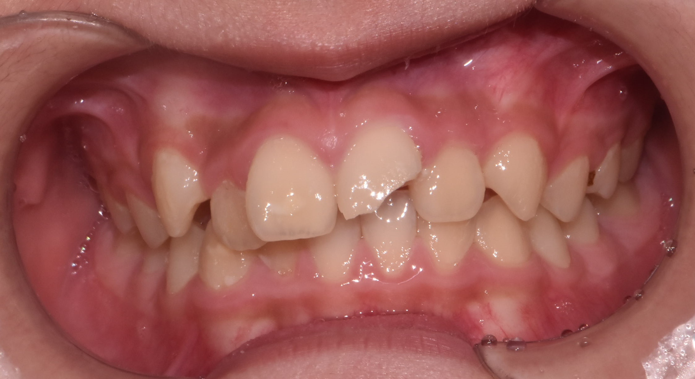 Before